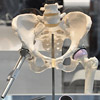 В Омске начнут выпускать импланты с помощью 3D-технологий