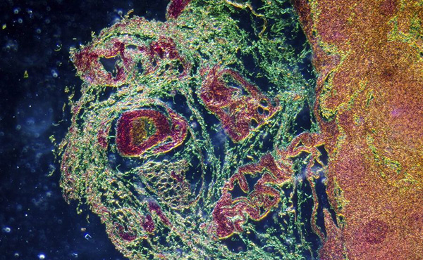 В иммунной системе человека нашли «микроорган»