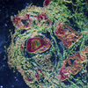 В иммунной системе человека нашли «микроорган»