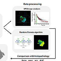 Ученые с 87% точностью диагностировали опухоли головного мозга по свечению тканей
