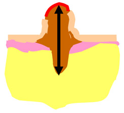 Схема определения толщины опухоли по Бреслоу
